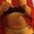 40 days post op