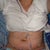 48 hours after surgery