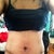 About 3 weeks post op.