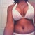 Bikini 10 days post-op
