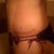10wks post op.....trying on my new swimsuit bottoms ( even though i need a tan)