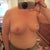 1 month post op