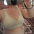 1 month post op