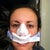 day of surgery. thank goodness for the "nose sling" to catch all the blood!