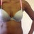 Day 16 Post-Op