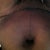 Belly button hole looks huge!!yikes