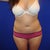 BEFORE - FEB 28th