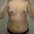pre-op front