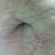 One stop Stretch Mark shop
