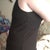 This is jest a few days post op with binder on.