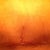 Swollen tummy, more so on the right as you can tell by the scar