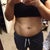 Two days before surgery