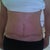 post up 9 weeks