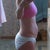 Tummy Tuck pre-op