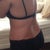 1day post op