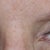 Eyebrow and eyeliner after my procedure.