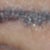 Closeup of left brow