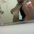 One day after surgery....