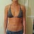 Before Implants