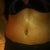9 days post op, flatter, but swollen