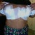 post op day 1
