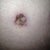 new belly button