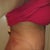 Day after surgery