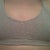 Frontal before