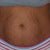 hello stretchmark city!...the belly