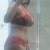 Still some swelling in my back and around my waist...hoping the massages and the garment will help
2 weeks post op