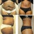 20 Day Post Op..... ok I didn't think I looked THAT BAD on the left! The pic of the left doesn't look like a Size 10 Pants Wearing Woman! but sooo glad that the RIGHT is Me now! Dr. Katsaros is extremely Gifted in his work!