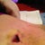 My poor BB. Very bruised.