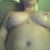 14 days post op