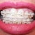 5wk before adjustment my R top tooth beside the front tooth is being pulled behind the front tooth.  My front teeth are still sitting on the neighboring teeth.  What part of pulling my teeth to the left and right does one not understand?