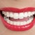 These are not my teeth.  I want very wide separated teeth like this.  I love longer front teeth.