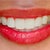 These are not my teeth.  I like teeth that are separated like piano keys. Each one evenly spaced, not on the others. I love longer front teeth. These are still somewhat crowded to me. I prefer next photo.