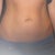 After 6 Weeks