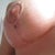 Right Breast. One itty bitty scab left.