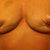 37 Days Post