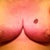 Week 5 Post Op