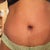 5 Mos PO.. still not flat. my BB has a good shape. Too many stretch marks too that are more obvious than I was hoping them to be.