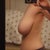 4 days before reduction, side