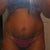 BEFORE FRONTAL