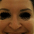 Before - you can see how my nose droops and changes shape when smiling