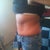 Before tummy tuck
side view :(