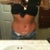 5 weeks po. happy with results, still being patient for those muffin tops to go away lol