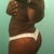 6 weeks post op - Back view.  Lots of swelling in lower back.  Butt is still hard.  Can't wait for i to finish "POP" out! LOL