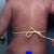 2 weeks post op