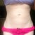 Lumpy tummy.. For now!