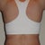 After (day 10 post-op)